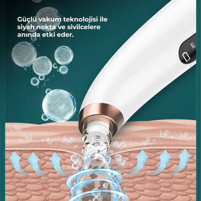 Neutron Su Hazneli Siyah Nokta Temizleme Cihazı - 5