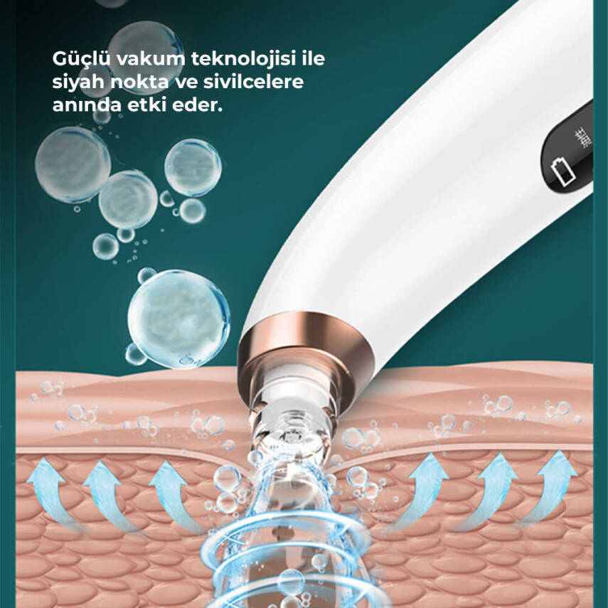 Neutron Su Hazneli Siyah Nokta Temizleme Cihazı - 5