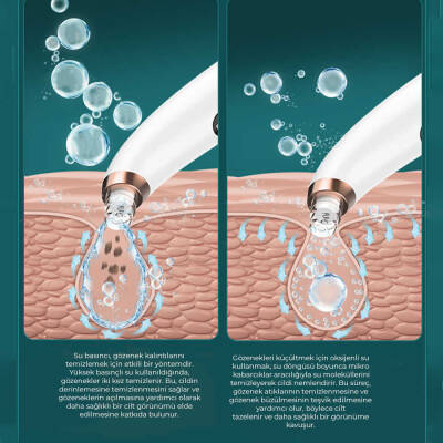 Neutron Su Hazneli Siyah Nokta Temizleme Cihazı - 6